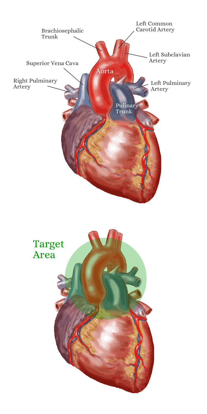 The human heart